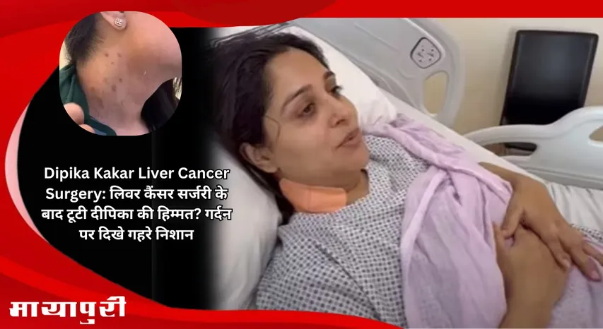 Dipika Kakar Liver Cancer Surgery: Did Deepika courage break after liver cancer surgery Deep marks seen on neck